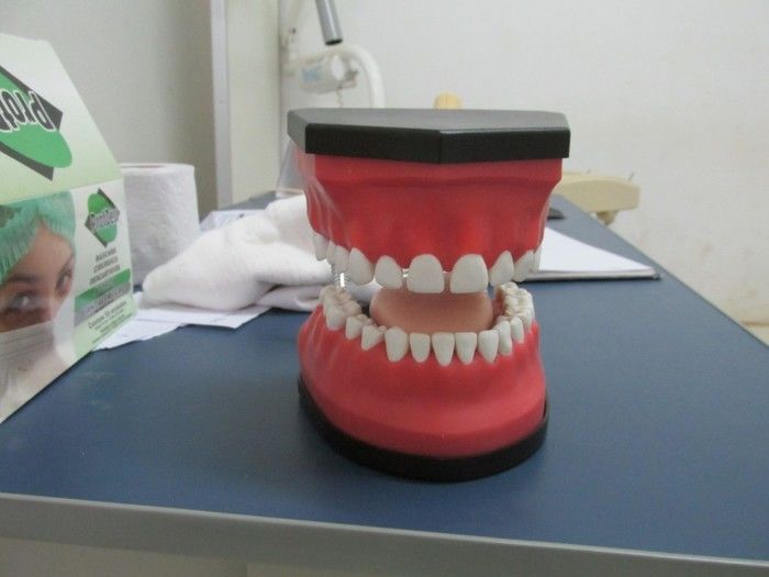 Secretaria de Saúde Faz Entrega de 30 próteses Dentarias por mês em Agricolândia   - Imagem 6