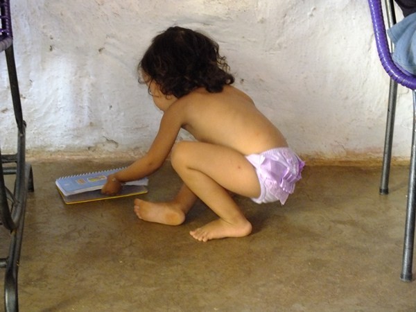 Criança tem ossos de Vidro no interior do Piaui  - Imagem 3