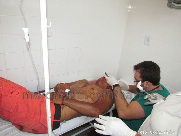 Durante briga, homem é atingido por tiro de espingarda em Barras - Imagem 5