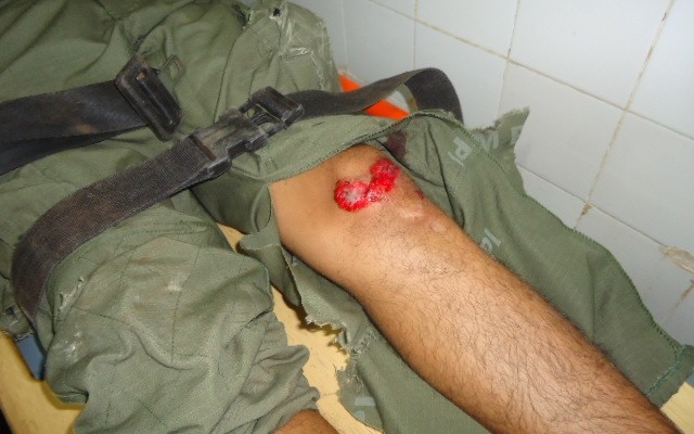 Policial Militar sofre grave acidente ao retornar para Teresina após as eleições - Imagem 5