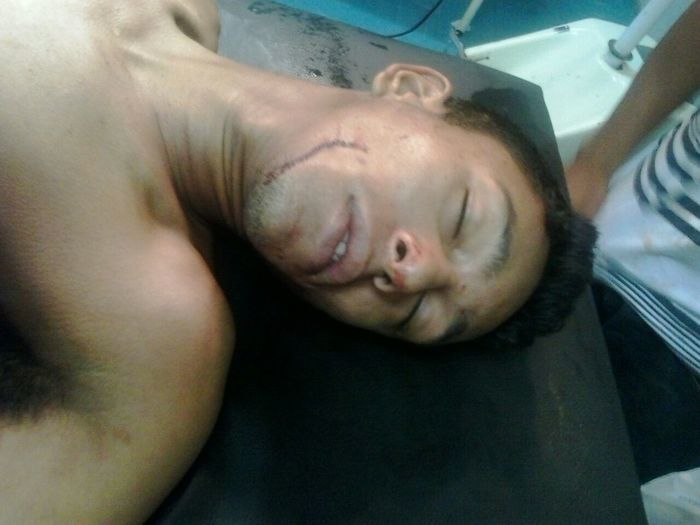 Homem esfaqueia irmão durante comemoração do seu aniversário no Piauí - Imagem 2