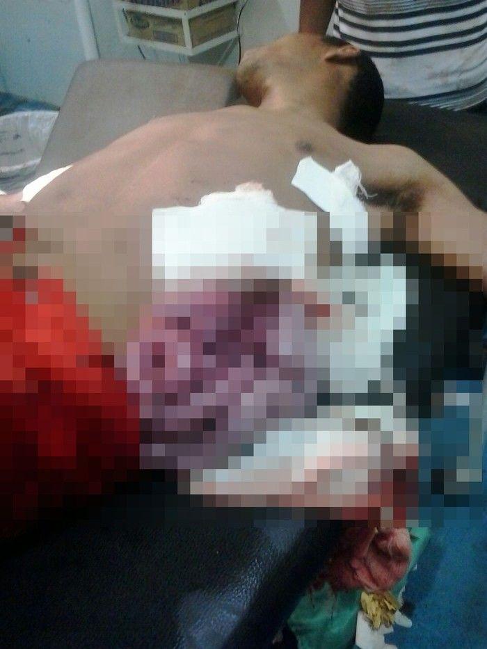 Homem esfaqueia irmão durante comemoração do seu aniversário no Piauí - Imagem 1