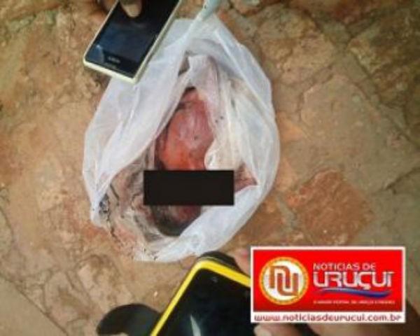 Corpo de rescém-nascido é encontrado dentro de tambor de lixo no Hospital de Uruçuí - Imagem 1