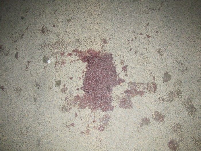 Acidente de Moto no Bairro Baixa deixa uma Pessoa Gravemente Ferida   - Imagem 5