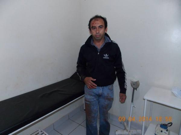 Jovens se acidentam na BR 343 - Imagem 3