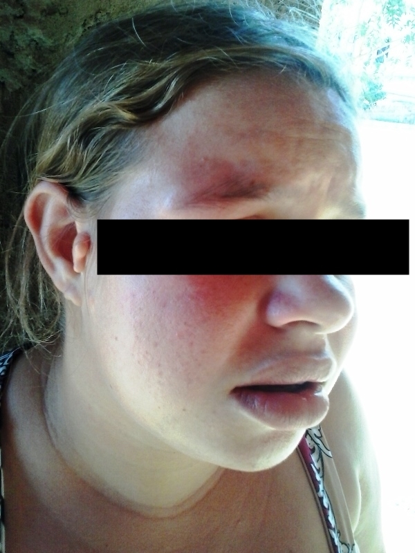 Pai agride filha grávida - Imagem 1