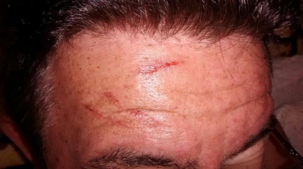 Aposentado é assaltado na porta de sua própria residência - Imagem 1