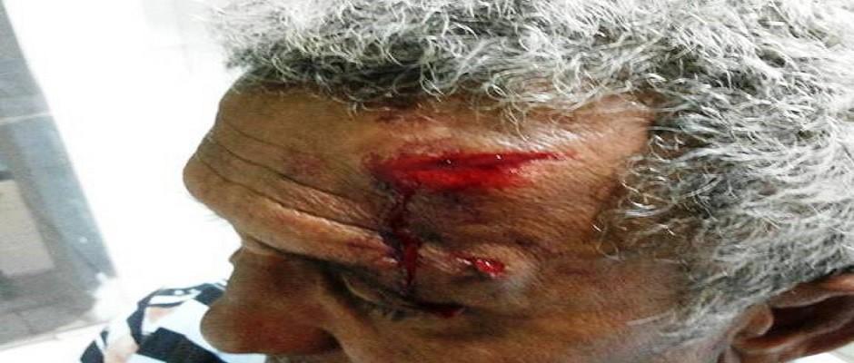  Idoso de 62 anos é agredido a pauladas durante briga no trânsito