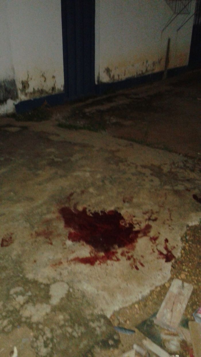 Acidente de Moto no Centro de Agricolândia deixa um jovem com Braço quebrado  - Imagem 5