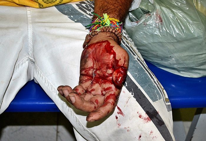 Após sofrer tentativa de roubo, homem é lesionado e se ajoelha perante acusado - Imagem 3