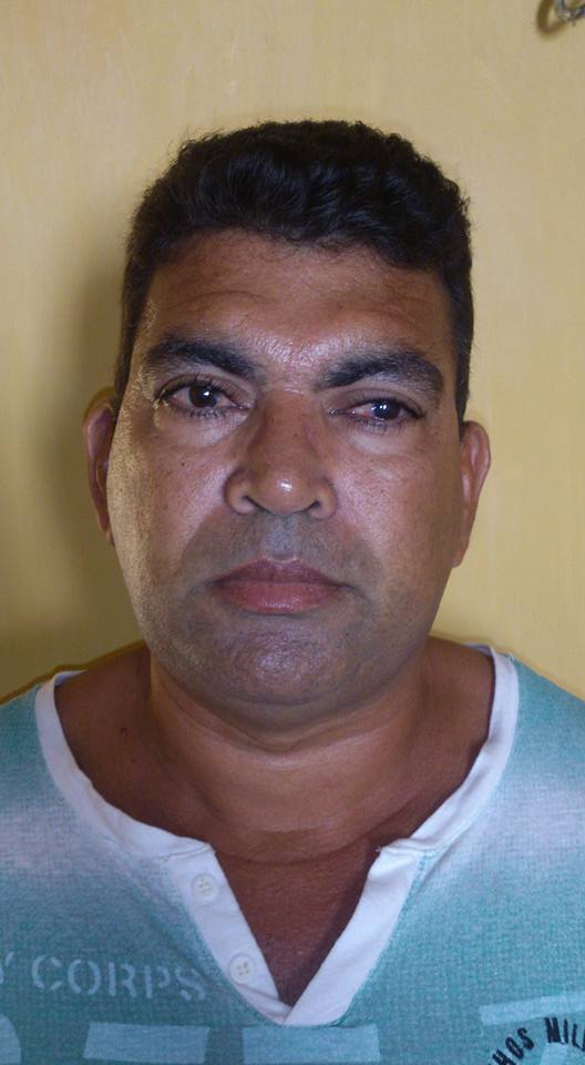 Homem de 47 anos precisa de ajuda para não cegar!!! - Imagem 4