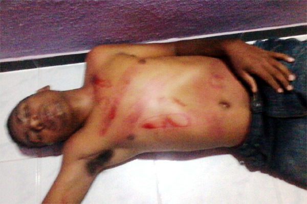 Jovem é espancado e arrastado pelas ruas na região de Campo Maior - Imagem 1