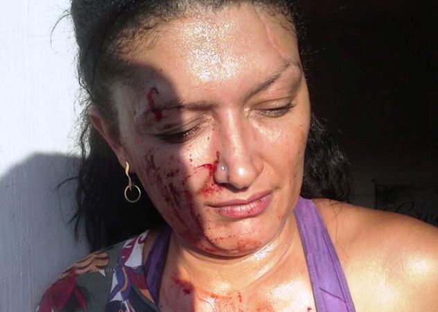 Mulher é presa depois de aplicar facada no marido durante briga em bar - Imagem 2