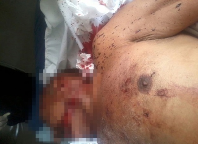 Idoso morre após sofre grave acidente na PI-115  - Imagem 1