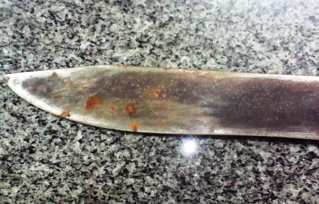 Briga de vizinhos termina com um ferido a facas na região de Campo Maior  - Imagem 3