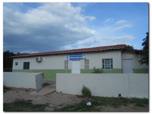 Postos de Saúde da zona rural e do Sossego são ampliados - Imagem 3