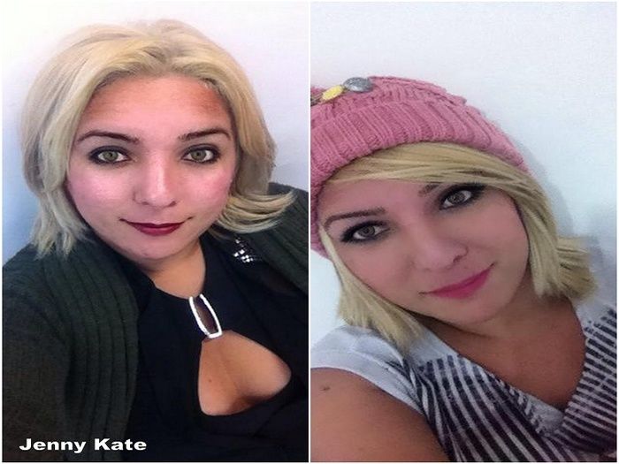 Jenny Kate realiza sua tão sonhada cirurgia de “Adequação Sexual” - Imagem 1