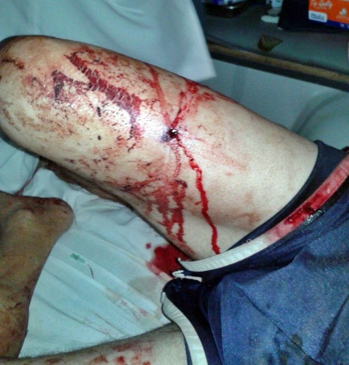 Homem é baleado durante assalto, reage e mata bandido no norte do Piauí - Imagem 2