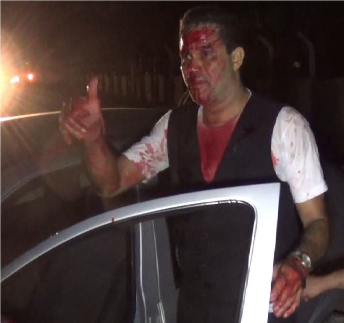 Motorista alcoolizado atropela ciclista e derruba poste em Parnaíba - Imagem 2