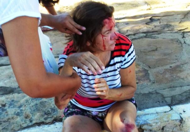 Filho de ex-prefeito é preso após ferir mulher em colisão  - Imagem 1