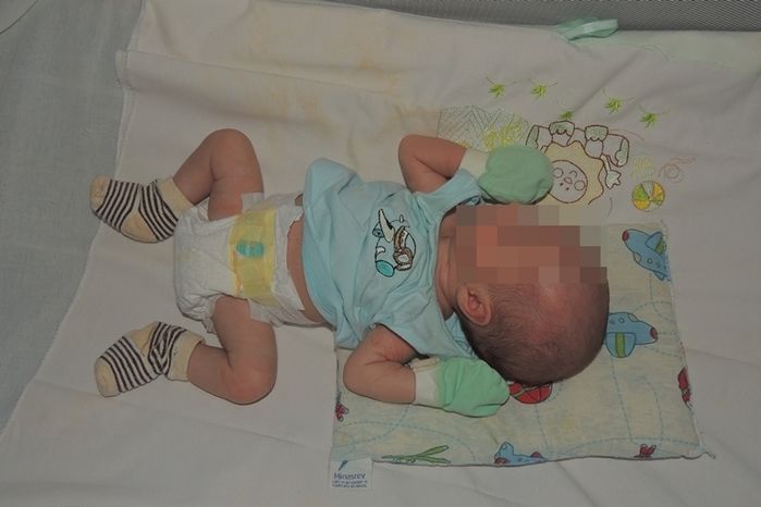 Câncer muda planos e história de amor de um casal de jovens - Imagem 9