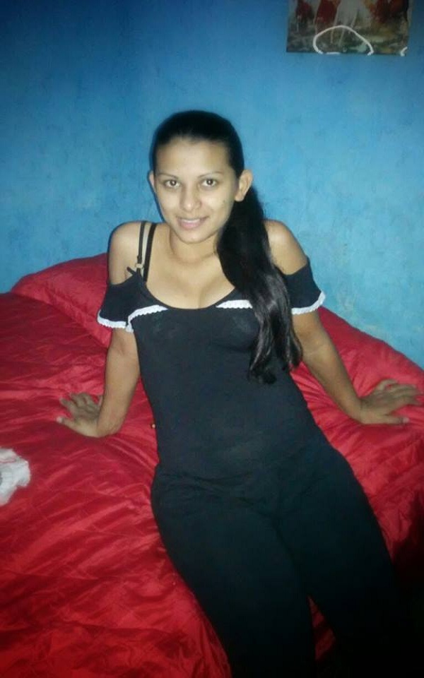 Câncer muda planos e história de amor de um casal de jovens - Imagem 2