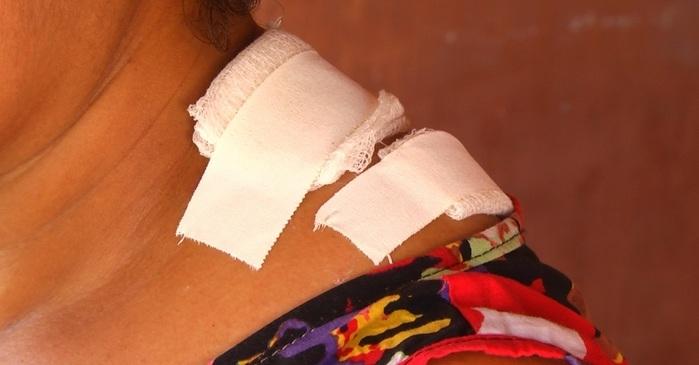 Mulher foi atingida de raspão no ombro. (Crédito: Kairo Amaral)
