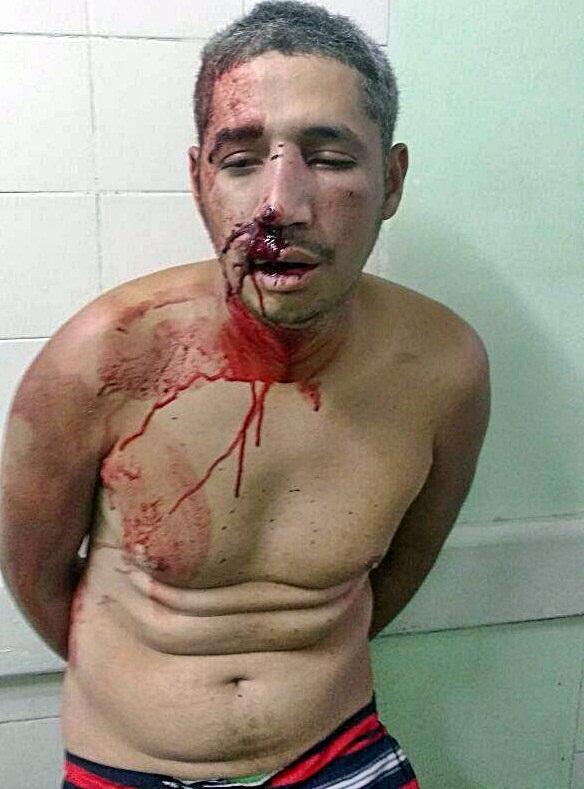 Acusado de matar a cadela foi espancado pela população.  (Crédito: Kairo Amaral)