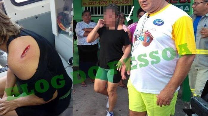 Mulher é atingida por bala perdida na principal avenida de Parnaíba - Imagem 1