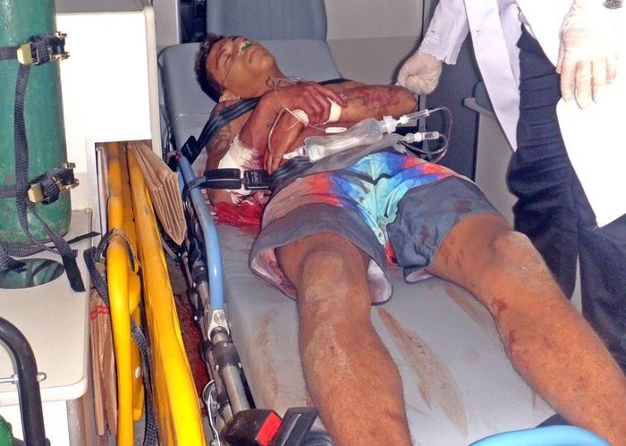 Adolescente baleado em Araioses-MA morre no HEDA em Parnaíba  - Imagem 1