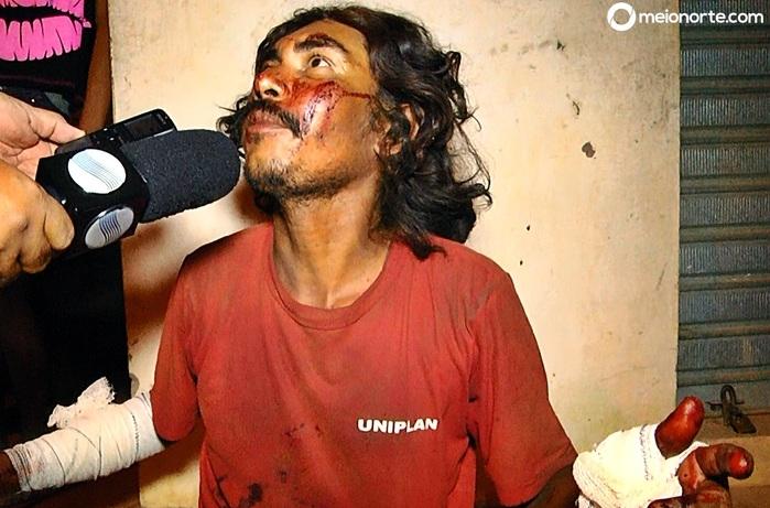 Homem é ferido por facão após bebedeira em Parnaíba - Imagem 3