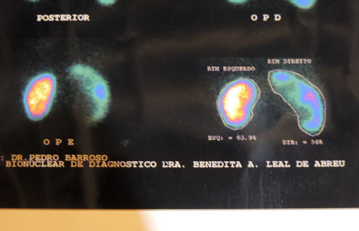 Jovem faz apelo à população para conseguir dinheiro para sua cirurgia de urgência - Imagem 4