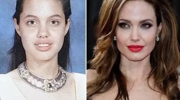 Ryca Vírus: Confira o Antes & Depois da fama de algumas celebridades - imagem 8727