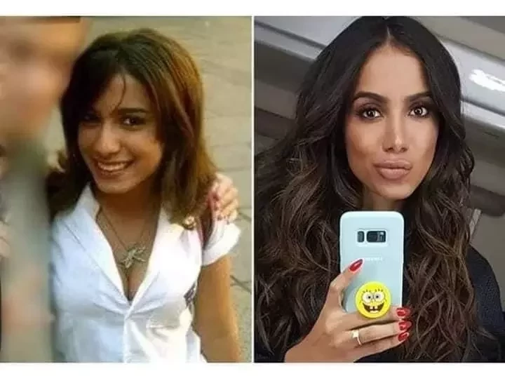 Ryca Vírus: Confira o Antes & Depois da fama de algumas celebridades - imagem 8726