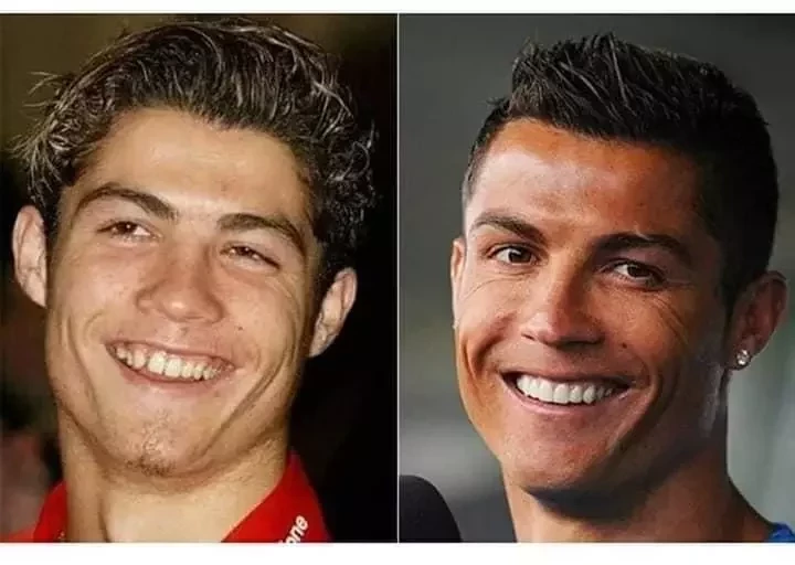 Ryca Vírus: Confira o Antes & Depois da fama de algumas celebridades - imagem 8734