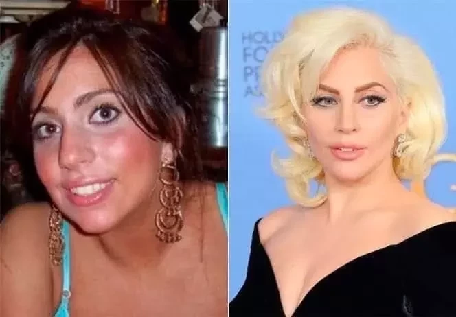 Ryca Vírus: Confira o Antes & Depois da fama de algumas celebridades - imagem 8730