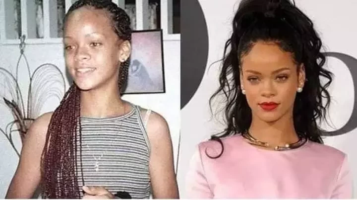 Ryca Vírus: Confira o Antes & Depois da fama de algumas celebridades - imagem 8724