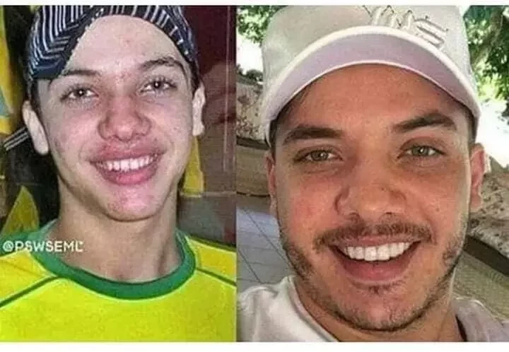 Ryca Vírus: Confira o Antes & Depois da fama de algumas celebridades - imagem 8737