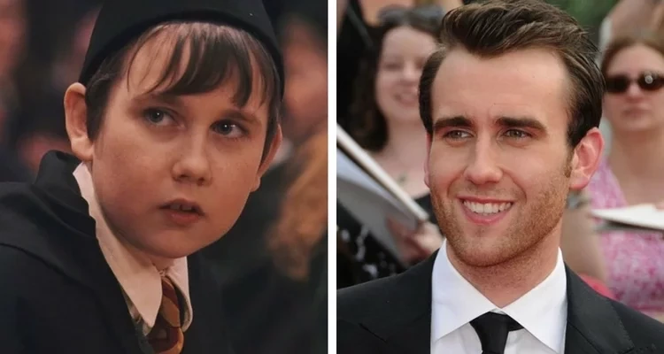 Veja fotos dos patinhos feios que se transformaram em famosos lindos - imagem 10637