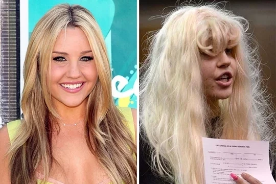 Confira fotos das  celebridades antes e depois de usarem drogas - imagem 11537