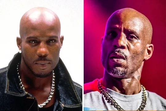 Confira fotos das  celebridades antes e depois de usarem drogas - imagem 11533