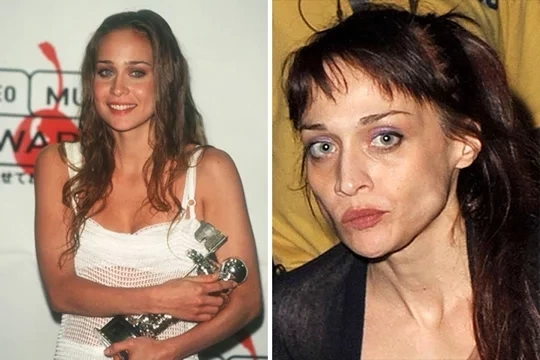 Confira fotos das  celebridades antes e depois de usarem drogas - imagem 11532