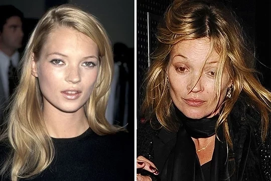 Confira fotos das  celebridades antes e depois de usarem drogas - imagem 11538