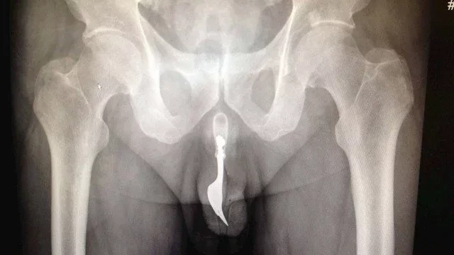 Confira 6 pedidos estranhos no sexo que farão você se sentir careta  - imagem 9729