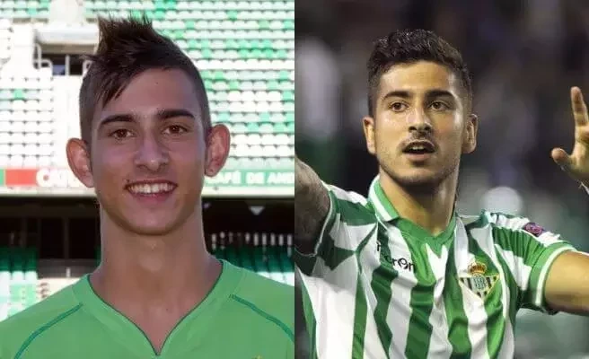 Confira fotos de atletas antes das cirurgias que são inacreditáveis  - imagem 12693