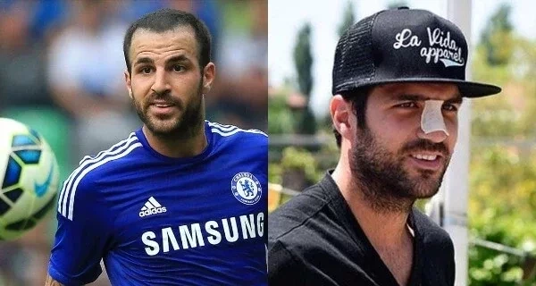 Confira fotos de atletas antes das cirurgias que são inacreditáveis  - imagem 12702