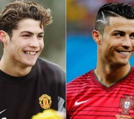 Confira fotos de atletas antes das cirurgias que são inacreditáveis 