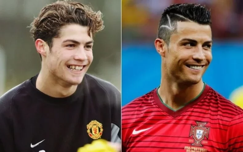 Confira fotos de atletas antes das cirurgias que são inacreditáveis  - imagem 12681