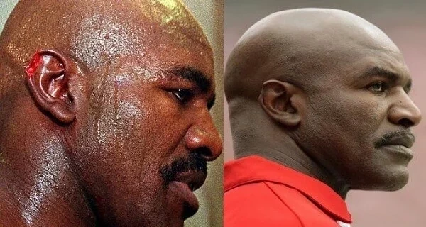 Confira fotos de atletas antes das cirurgias que são inacreditáveis  - imagem 12704