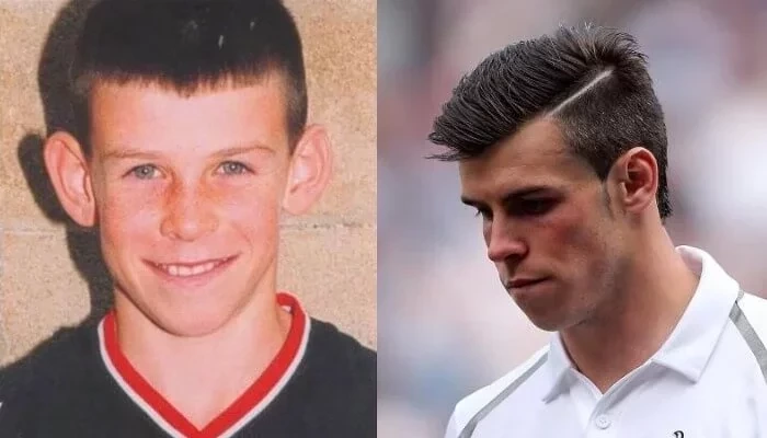 Confira fotos de atletas antes das cirurgias que são inacreditáveis  - imagem 12694